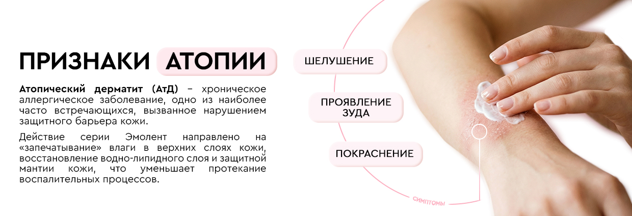 Признаки атопии